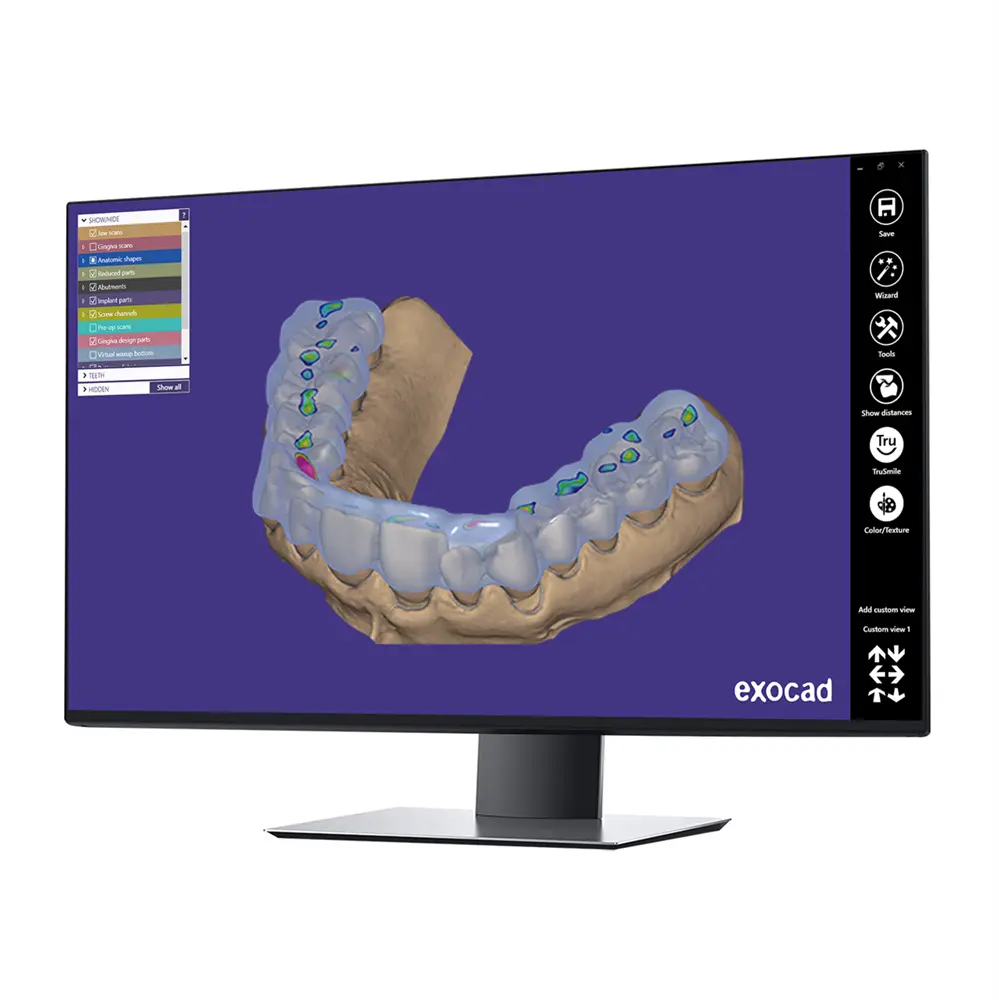 exocad DentalCAD Bite Splint Module - Perpetual