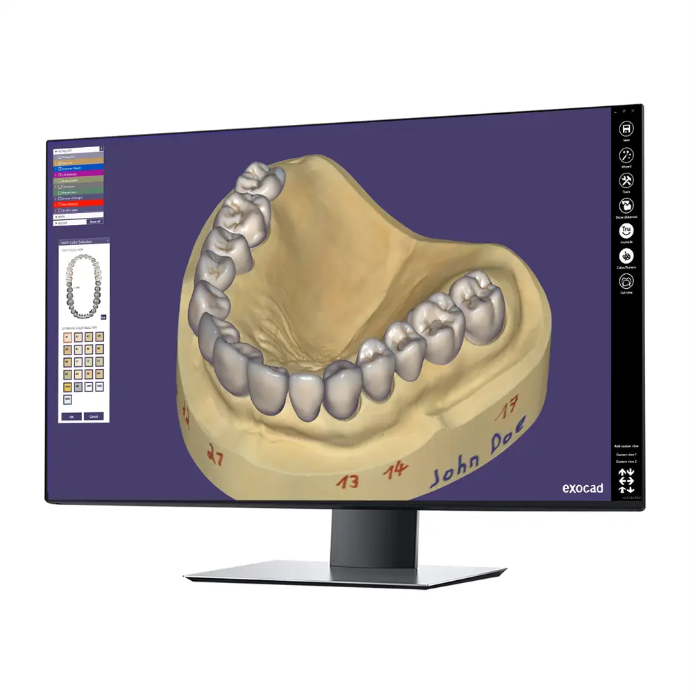 exocad DentalCAD TruSmile Module - Perpetual