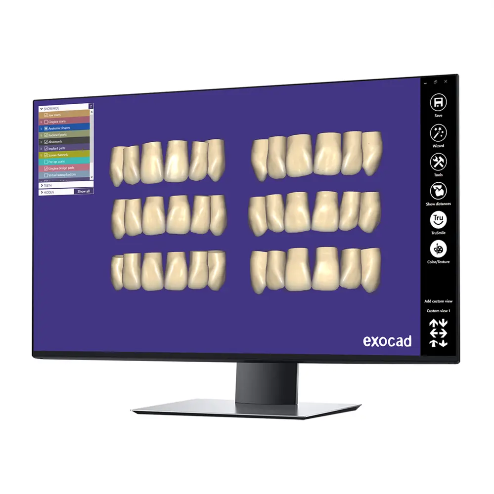 exocad DentalCAD ZRS Tooth Library Module - Perpetual