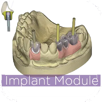 [AOMI-P] exocad DentalCAD Implant Module - Perpetual