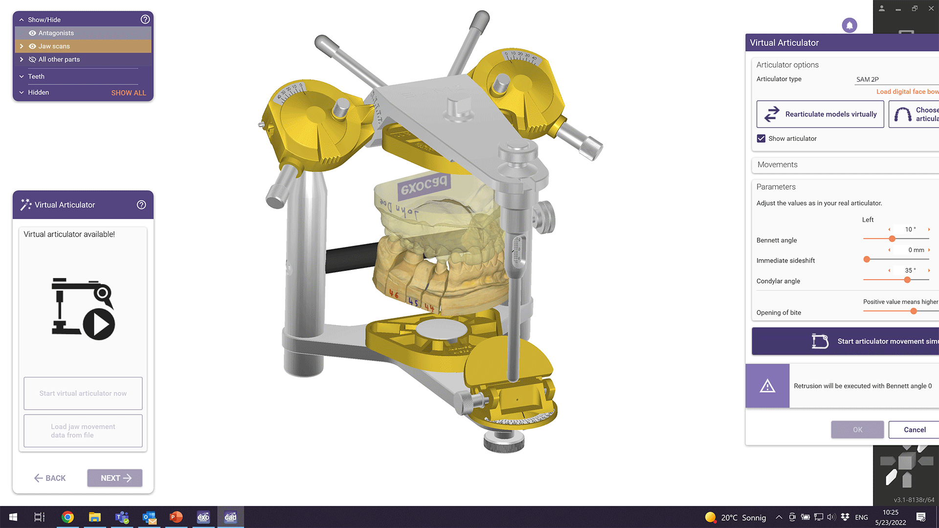 [AOMVA-P] exocad DentalCAD Virtual Articulator Module - Perpetual