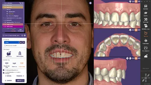 [AOMSC-P] exocad DentalCAD Smile Creator Module - Perpetual