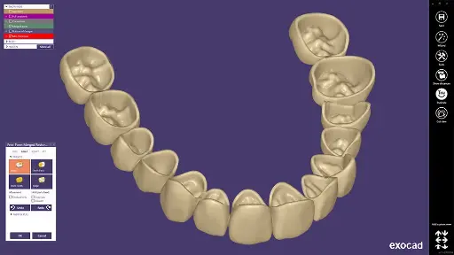 [AOMP-P] exocad DentalCAD Provisional Module - Perpetual