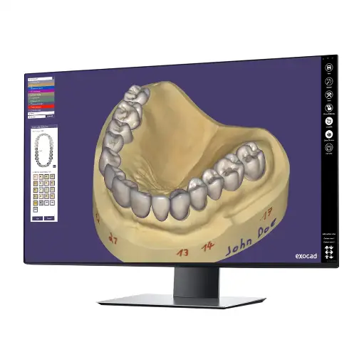 [AOMTS-P] exocad DentalCAD TruSmile Module - Perpetual