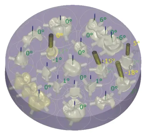 [AOMN-F] exocad DentalCAD Nesting Module - Flex